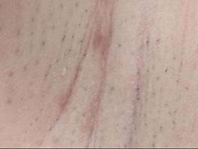 300人の腋 2　サンプル画像13